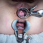 Worthwhile legal age teenager fisting shots.